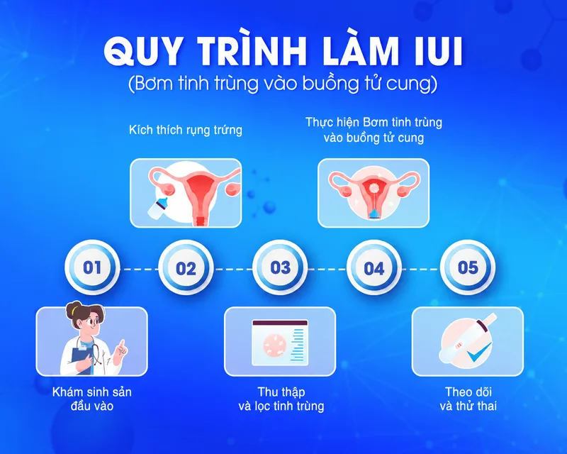 Quy trình thụ tinh nhân tạo thường gồm thăm khám, theo dõi rụng trứng, chuẩn bị tinh trùng, bơm tinh trùng và theo dõi sau thủ thuật.
